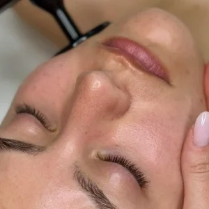 Diatermia Facial Potenciador | 4 sesiones